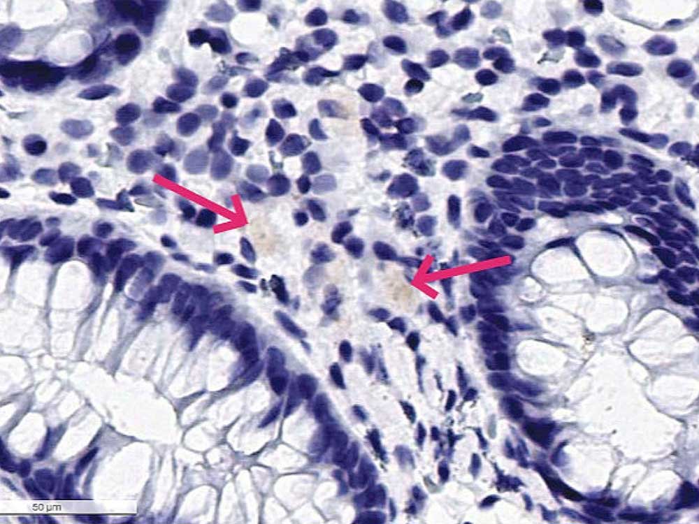 Long Covid Behandlungsanleitung: Wie entfernt man die in den Organen verbliebenen Viren? Long Covid Behandlungsanleitung: Wie entfernt man die in den Organen verbliebenen Viren?