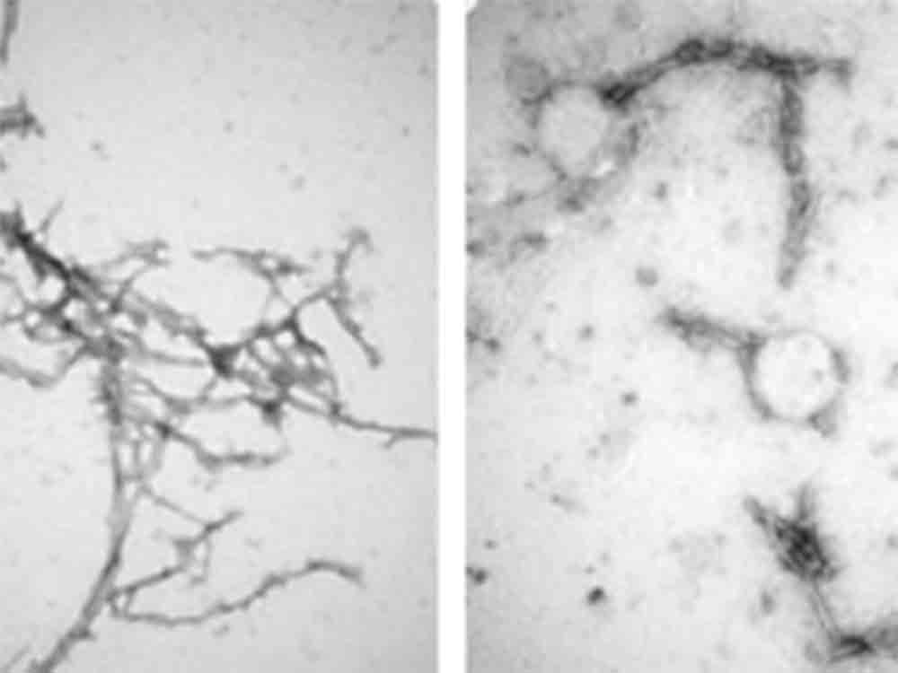 Nanokörper ordnen Eiweißklumpen im Hirn, Forscher ebnen Weg für neue Therapie gegen neurodegenerative Erkrankungen wie Alzheimer Nanokörper ordnen Eiweißklumpen im Hirn, Forscher ebnen Weg für neue Therapie gegen neurodegenerative Erkrankungen wie Alzheimer