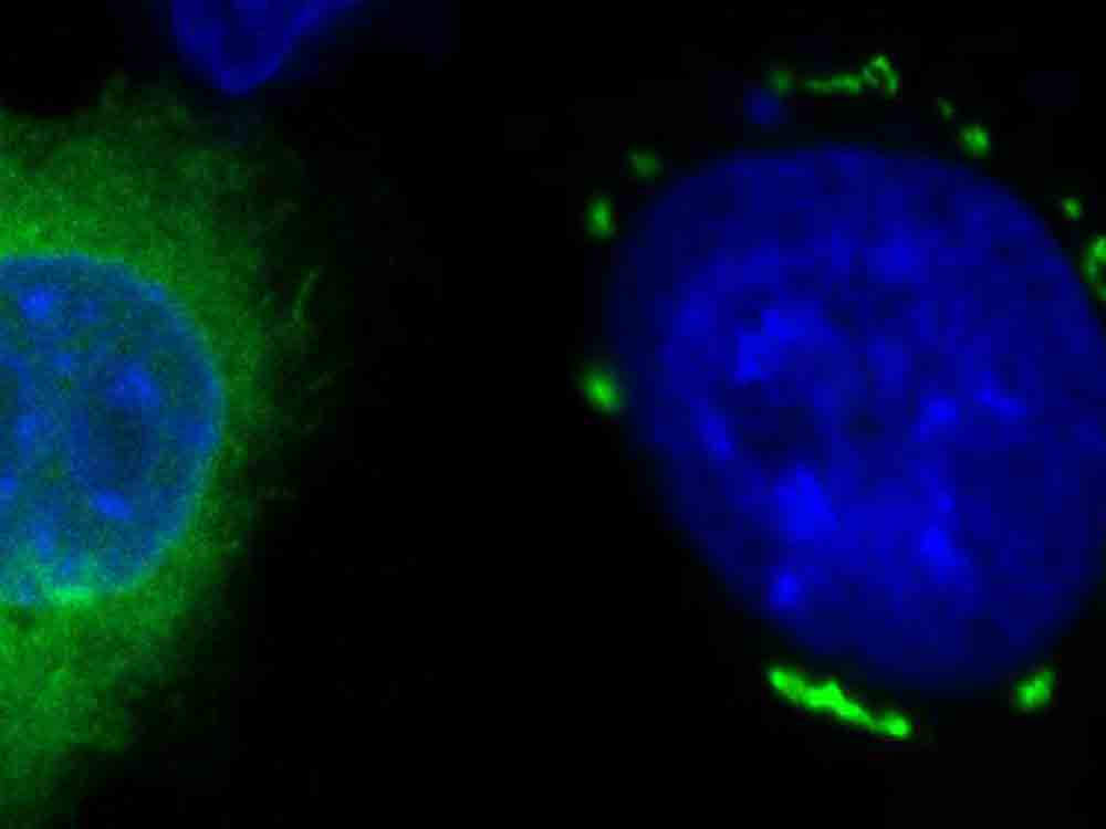 Neuer Ansatz in der Krebstherapie mit innovativem Mechanismus zur Induktion von Ferroptose, Helmholtz Zentrum München Neuer Ansatz in der Krebstherapie mit innovativem Mechanismus zur Induktion von Ferroptose, Helmholtz Zentrum München